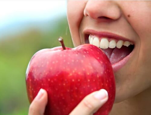 Dental Implants: Frequently Asked Questions Answered
